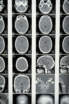 Células Sanguíneas no Cérebro: Pesquisadores Identificam Causas da Depressão