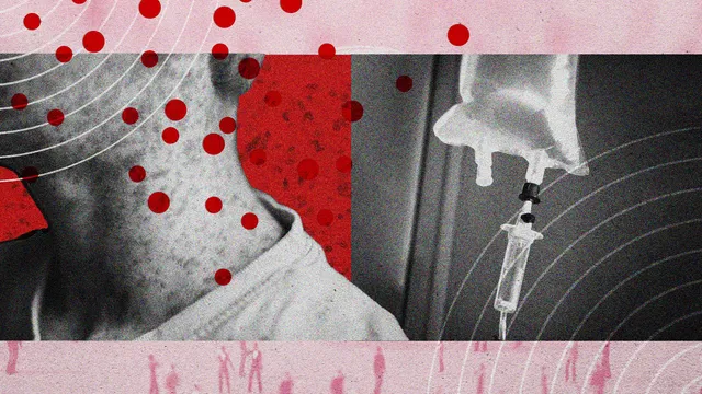 Tratamentos para Sarampo: uma Necessidade Crescente em Um Contexto de Pandemia